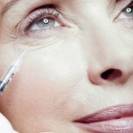 Botox injection